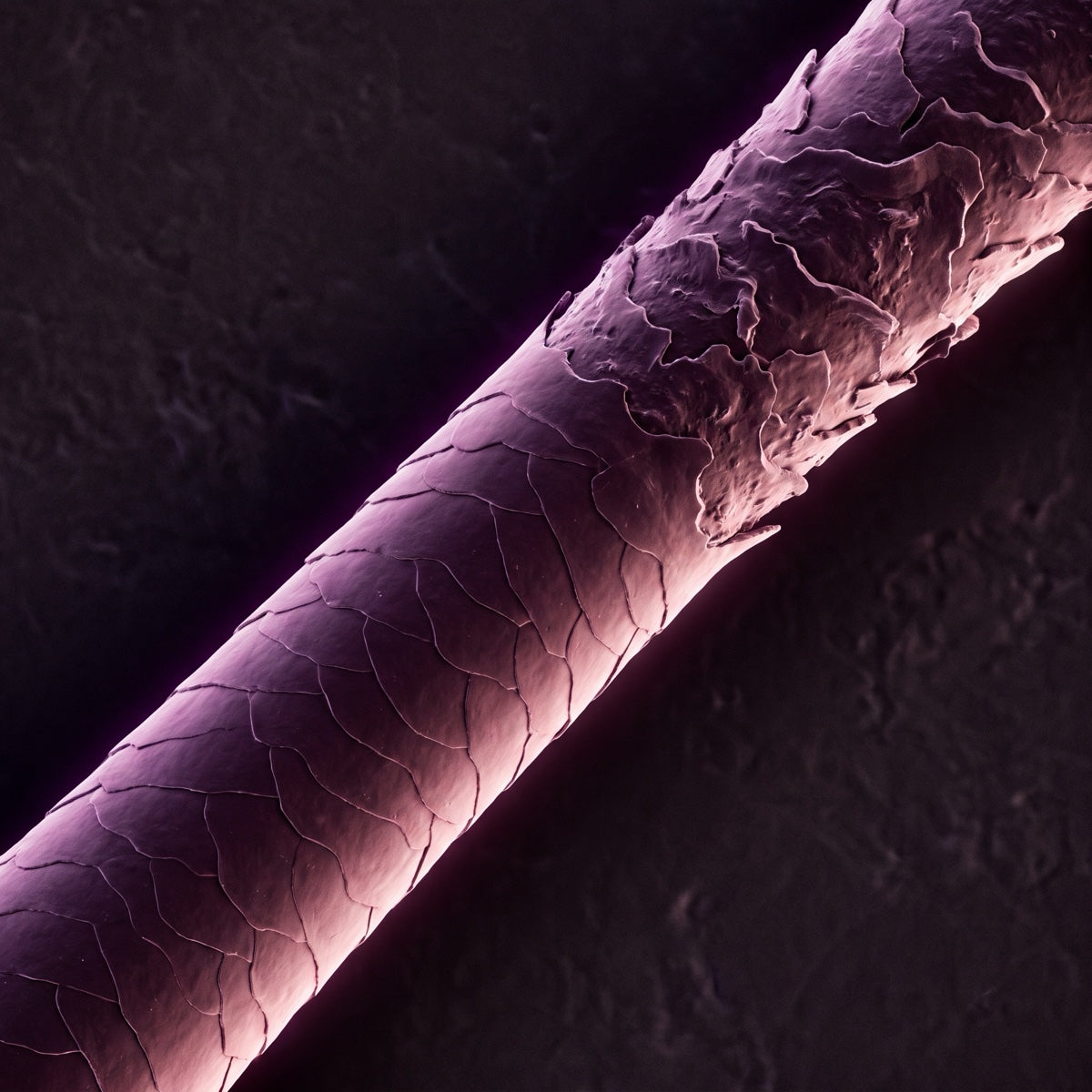 The cuticle